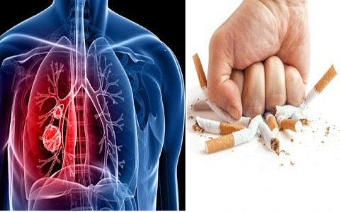 Bệnh ung thư phổi có phòng tránh được không?