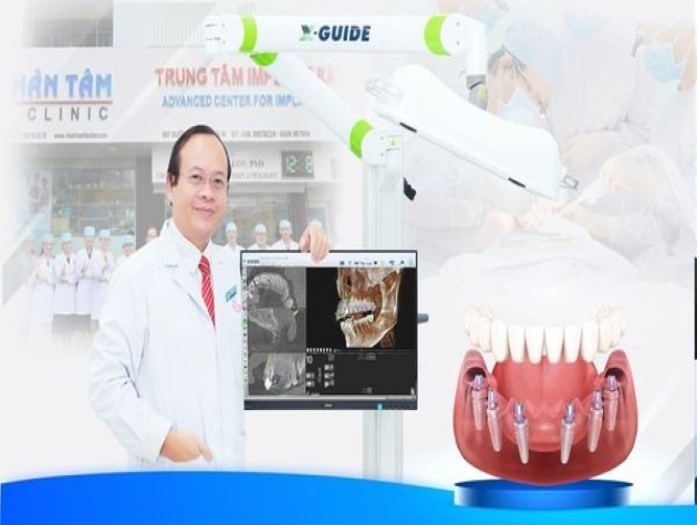 Trồng răng implant: Lựa chọn hoàn hảo cho nụ cười khỏe đẹp tại Nha khoa Nhân Tâm